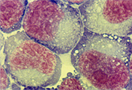 Cellules d'hépato-carcinome en culture témoin